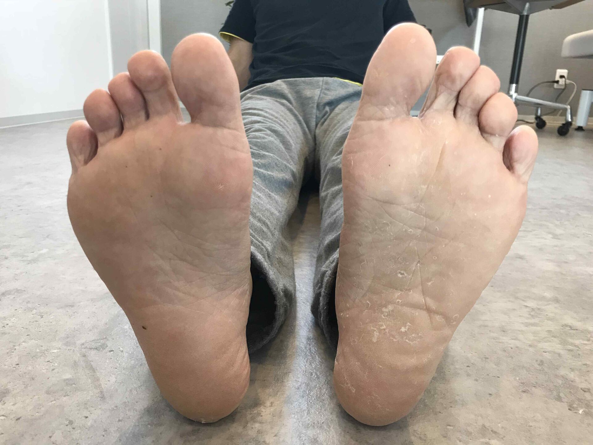 長い間悩んでいた腰痛がなくなり、部活動が出来るようになりました!