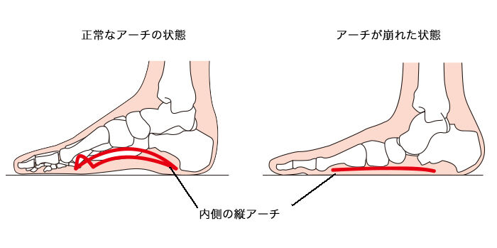 「走っていて」怪我が多い、調子が安定しない・・・　そんな時の対応方法